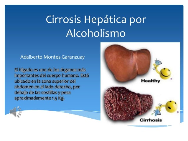 La codificación de alcohólico por la hipnosis