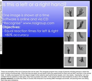Is this a left or a right hand?
Copyright Lorimer Moseley 2009




                                 One image is shown at ...