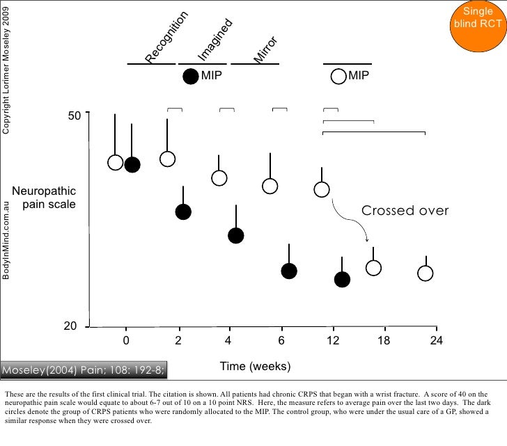 Graded Motor Imagery for Chronic Pain