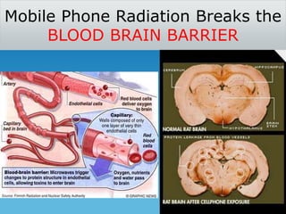 Mobile Phone Radiation Breaks the 
BLOOD BRAIN BARRIER 
 