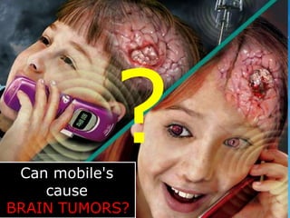Can mobile's 
cause 
BRAIN TUMORS? 
 