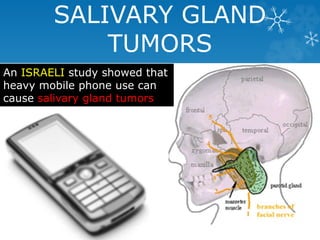 SALIVARY GLAND 
TUMORS 
An ISRAELI study showed that 
heavy mobile phone use can 
cause salivary gland tumors 
 