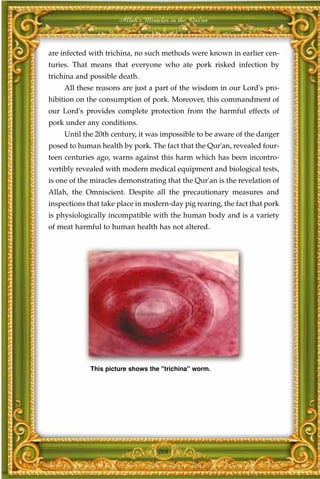 Allah's Miracles in the Qur'an



are infected with trichina, no such methods were known in earlier cen-
turies. That means that everyone who ate pork risked infection by
trichina and possible death.
     All these reasons are just a part of the wisdom in our Lord's pro-
hibition on the consumption of pork. Moreover, this commandment of
our Lord's provides complete protection from the harmful effects of
pork under any conditions.
     Until the 20th century, it was impossible to be aware of the danger
posed to human health by pork. The fact that the Qur'an, revealed four-
teen centuries ago, warns against this harm which has been incontro-
vertibly revealed with modern medical equipment and biological tests,
is one of the miracles demonstrating that the Qur'an is the revelation of
Allah, the Omniscient. Despite all the precautionary measures and
inspections that take place in modern-day pig rearing, the fact that pork
is physiologically incompatible with the human body and is a variety
of meat harmful to human health has not altered.




             This picture shows the "trichina" worm.




                                   208
 