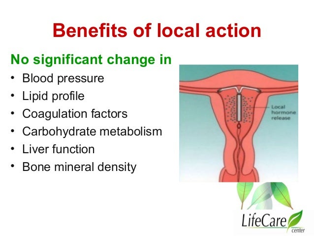 Levonorgestrel Intrauterine System (Lng-Ius) Side Effects