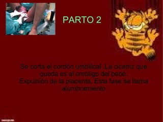 PARTO 2




Se corta el cordón umbilical .La cicatriz que
       queda es el ombligo del bebé.
Expulsión de la placenta. Esta fase se llama
               alumbramiento
 