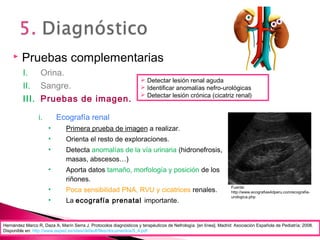  Pruebas complementarias
I. Orina.
II. Sangre.
III. Pruebas de imagen.
i. Ecografía renal
• Primera prueba de imagen a realizar.
• Orienta el resto de exploraciones.
• Detecta anomalías de la vía urinaria (hidronefrosis,
masas, abscesos…)
• Aporta datos tamaño, morfología y posición de los
riñones.
• Poca sensibilidad PNA, RVU y cicatrices renales.
• La ecografía prenatal importante.
Fuente:
http://www.ecografias4dperu.com/ecografia-
urologica.php
 Detectar lesión renal aguda
 Identificar anomalías nefro-urológicas
 Detectar lesión crónica (cicatriz renal)
Hernández Marco R, Daza A, Marín Serra J. Protocolos diagnósticos y terapéuticos de Nefrología. [en línea]. Madrid: Asociación Española de Pediatría; 2008.
Disponible en: http://www.aeped.es/sites/default/files/documentos/5_4.pdf
 