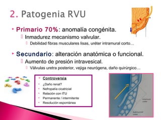  Primario 70%: anomalía congénita.
 Inmadurez mecanismo valvular.
 Debilidad fibras musculares lisas, uréter intramural corto…
 Secundario: alteración anatómica o funcional.
 Aumento de presión intravesical.
 Válvulas uretra posterior, vejiga neurógena, daño quirúrgico…
 Controversia
 ¿Daño renal?
 Nefropatía cicatricial
 Relación con ITU
 Permanente / intermitente
 Resolución espontánea
 