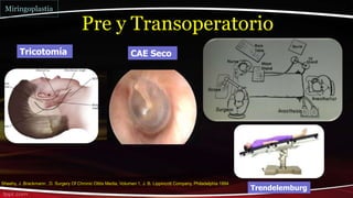 Sheehy, J. Brackmann , D. Surgery Of Chronic Otitis Media, Volumen 1, J. B. Lippincott Company, Philadelphia 1994
Pre y Transoperatorio
Tricotomía CAE Seco
Trendelemburg
Miringoplastia
 