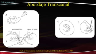 Abordaje Transcanal
Miringoplastia
Fisch, U. Timpanoplastia, Mastoidectomía y Cirugía del Estribo. Editorial Thieme. 1994
 