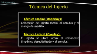  Técnica Medial (Underlay):
 Colocación del injerto medial al annulus y al
mango de martillo.
 Técnica Lateral (Overlay):
 El injerto se ubica lateral al remanente
timpánico desepitelizado y al annulus.
Técnica del Injerto
Miringoplastia
Fisch, U. Timpanoplastia, Mastoidectomía y Cirugía del Estribo. Editorial Thieme. 1994
 
