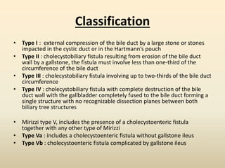 Classification
• Type I : external compression of the bile duct by a large stone or stones
impacted in the cystic duct or in the Hartmann’s pouch
• Type II : cholecystobiliary fistula resulting from erosion of the bile duct
wall by a gallstone, the fistula must involve less than one-third of the
circumference of the bile duct
• Type III : cholecystobiliary fistula involving up to two-thirds of the bile duct
circumference
• Type IV : cholecystobiliary fistula with complete destruction of the bile
duct wall with the gallbladder completely fused to the bile duct forming a
single structure with no recognizable dissection planes between both
biliary tree structures
• Mirizzi type V, includes the presence of a cholecystoenteric fistula
together with any other type of Mirizzi
• Type Va : includes a cholecystoenteric fistula without gallstone ileus
• Type Vb : cholecystoenteric fistula complicated by gallstone ileus
 