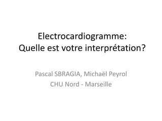 Electrocardiogramme:
Quelle est votre interprétation?

    Pascal SBRAGIA, Michaël Peyrol
         CHU Nord - Marseille
 