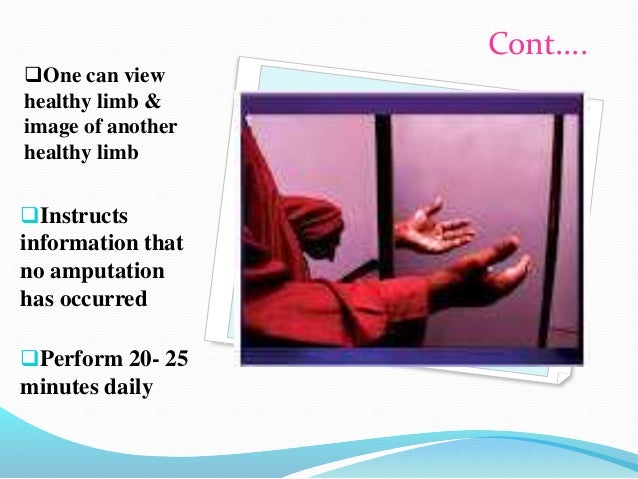 stroke rehabilitation ppt presentation Stroke rehabilitation.