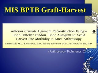 MIS-BTB | PDF