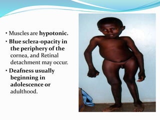• Muscles are hypotonic.
• Blue sclera-opacity in
the periphery of the
cornea, and Retinal
detachment may occur.
• Deafness usually
beginning in
adolescence or
adulthood.
 