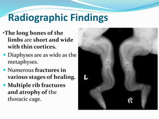 Radiographic Findings
•The long bones of the
limbs are short and wide
with thin cortices.
 Diaphyses are as wide as the
metaphyses.
 Numerous fractures in
various stages of healing.
 Multiple rib fractures
and atrophy of the
thoracic cage.
 