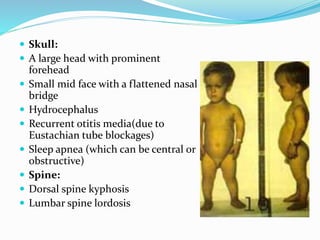  Skull:
 A large head with prominent
forehead
 Small mid face with a flattened nasal
bridge
 Hydrocephalus
 Recurrent otitis media(due to
Eustachian tube blockages)
 Sleep apnea (which can be central or
obstructive)
 Spine:
 Dorsal spine kyphosis
 Lumbar spine lordosis
 