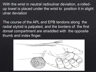 With the wrist in neutral radioulnar deviation, a rolled-
up towel is placed under the wrist to position it in slight
ulnar deviation
The course of the APL and EPB tendons along the
radial styloid is palpated, and the borders of the first
dorsal compartment are straddled with the opposite
thumb and index finger.
 
