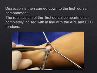 Misc. affections of soft tissue