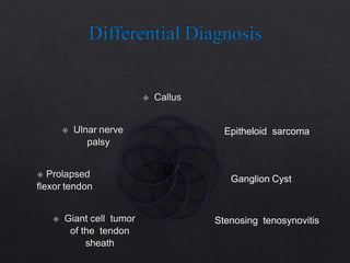 Epitheloid sarcoma
Ganglion Cyst
Stenosing tenosynovitis
 