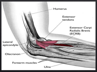 Misc. affections of soft tissue