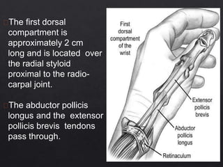 The first dorsal
compartment is
approximately 2 cm
long and is located over
the radial styloid
proximal to the radio-
carpal joint.
The abductor pollicis
longus and the extensor
pollicis brevis tendons
pass through.
 