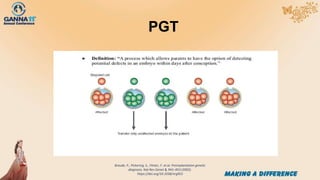 PGT
Braude, P., Pickering, S., Flinter, F. et al. Preimplantation genetic
diagnosis. Nat Rev Genet 3, 941–953 (2002).
https://doi.org/10.1038/nrg953
 