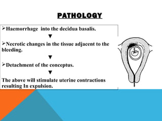 PATHOLOGYPATHOLOGY
Haemorrhage into the decidua basalis.
▼
Necrotic changes in the tissue adjacent to the
bleeding.
▼
Detachment of the conceptus.
▼
The above will stimulate uterine contractions
resulting In expulsion.
 