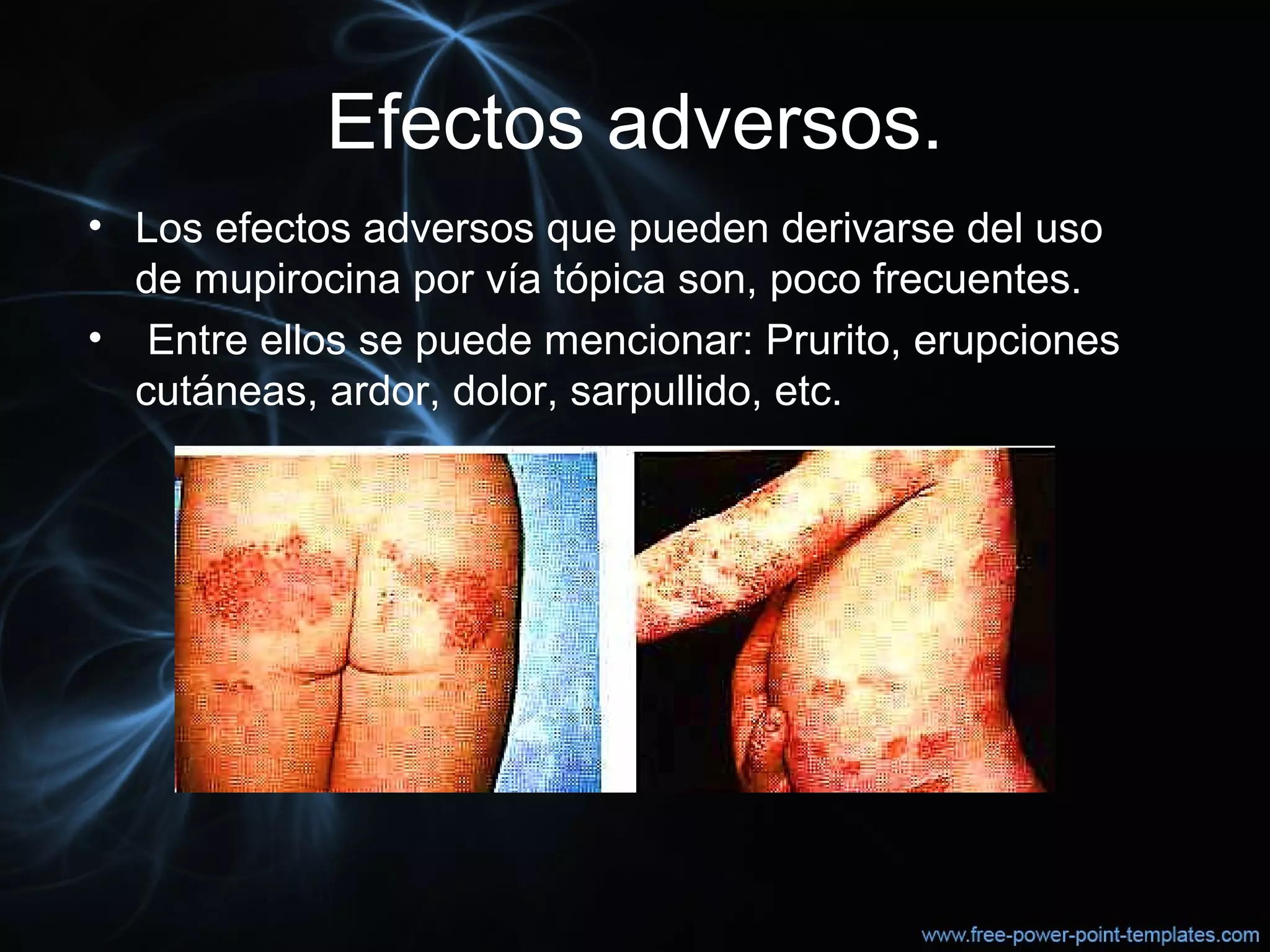 Efectos adversos.
• Los efectos adversos que pueden derivarse del uso 
de mupirocina por vía tópica son, poco frecuentes.
•  Entre ellos se puede mencionar: Prurito, erupciones 
cutáneas, ardor, dolor, sarpullido, etc.
 