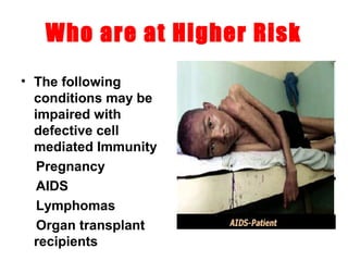 Who are at Higher Risk
• The following
conditions may be
impaired with
defective cell
mediated Immunity
Pregnancy
AIDS
Lymphomas
Organ transplant
recipients
 