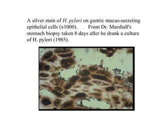 A silver stain of H. pylori on gastric mucus-secreting
epithelial cells (x1000). From Dr. Marshall's
stomach biopsy taken 8 days after he drank a culture
of H. pylori (1985).
 