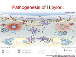 Pathogenesis of H.pylori.
 