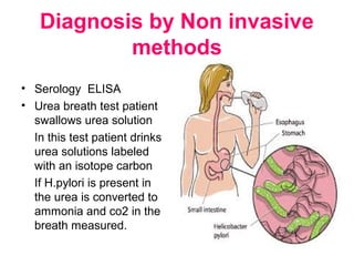 Diagnosis by Non invasive
methods
• Serology ELISA
• Urea breath test patient
swallows urea solution
In this test patient drinks
urea solutions labeled
with an isotope carbon
If H.pylori is present in
the urea is converted to
ammonia and co2 in the
breath measured.
 