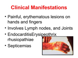 Clinical Manifestations
• Painful, erythematous lesions on
hands and fingers
• Involves Lymph nodes, and Joints
• EndocarditisErysipeothrix
rhusiopathiae
• Septicemias
 