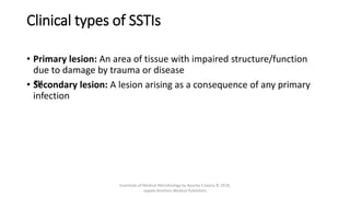 Clinical types of SSTIs
• Primary lesion: An area of tissue with impaired structure/function
due to damage by trauma or disease
• ™
Secondary lesion: A lesion arising as a consequence of any primary
infection
Essentials of Medical Microbiology by Apurba S Sastry © 2018,
Jaypee Brothers Medical Publishers
 