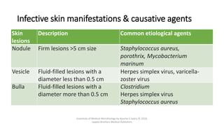 Infective skin manifestations & causative agents
Skin
lesions
Description Common etiological agents
Nodule Firm lesions >5 cm size Staphylococcus aureus,
porothrix, Mycobacterium
marinum
Vesicle Fluid-filled lesions with a
diameter less than 0.5 cm
Herpes simplex virus, varicella-
zoster virus
Bulla Fluid-filled lesions with a
diameter more than 0.5 cm
Clostridium
Herpes simplex virus
Staphylococcus aureus
Essentials of Medical Microbiology by Apurba S Sastry © 2018,
Jaypee Brothers Medical Publishers
 