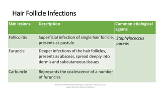 Hair Follicle Infections
Skin lesions Description Common etiological
agents
Folliculitis Superficial infection of single hair follicle,
presents as pustule
Staphylococcus
aureus
Furuncle Deeper infections of the hair follicles,
presents as abscess, spread deeply into
dermis and subcutaneous tissues
Carbuncle Represents the coalescence of a number
of furuncles
Essentials of Medical Microbiology by Apurba S Sastry © 2018,
Jaypee Brothers Medical Publishers
 