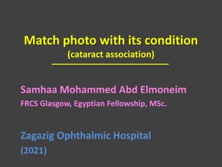 Match photo with its condition
(cataract association)
Samhaa Mohammed Abd Elmoneim
FRCS Glasgow, Egyptian Fellowship, MSc.
Zagazig Ophthalmic Hospital
(2021)
 
