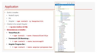 Application
• Outils à installer :
• NodeJS (npm)
• Git
• Angular : > npm install –g @angular/cli
• Création d’un projet Angular :
• > ng new medico-ml-tfjs
• Démendances à installer :
• TensorFlow.JS :
• > npm install --save @tensorflow/tfjs
• Framework CSS Bootstrap :
• > npm install --save bootstrap@3
• Angular Progress Bar :
• > npm install --save angular-progress-bar
 
