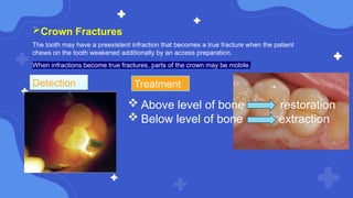 Infraction Tooth endodontic mishaps access, shaping, and obturation | PPTX