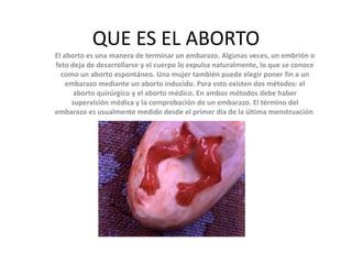 QUE ES EL ABORTO
El aborto es una manera de terminar un embarazo. Algunas veces, un embrión o
feto deja de desarrollarse y el cuerpo lo expulsa naturalmente, lo que se conoce
como un aborto espontáneo. Una mujer también puede elegir poner fin a un
embarazo mediante un aborto inducido. Para esto existen dos métodos: el
aborto quirúrgico y el aborto médico. En ambos métodos debe haber
supervisión médica y la comprobación de un embarazo. El término del
embarazo es usualmente medido desde el primer día de la última menstruación.
 