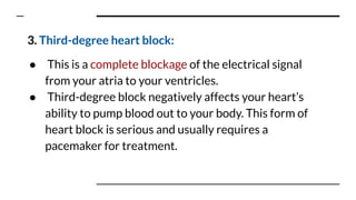 Types of heart blocks with it's ecg variations | PPT