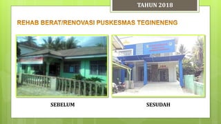 TAHUN 2018
SESUDAHSEBELUM
 