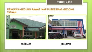 TAHUN 2018
SESUDAHSEBELUM
 