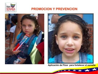 PROMOCION Y PREVENCION   Aplicación de Flúor  para fortalecer el esmalte 