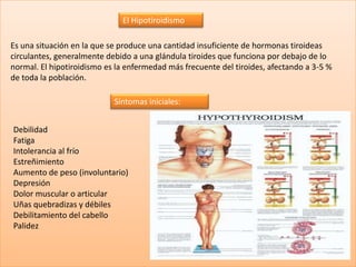 El Hipotiroidismo

Es una situación en la que se produce una cantidad insuficiente de hormonas tiroideas
circulantes, generalmente debido a una glándula tiroides que funciona por debajo de lo
normal. El hipotiroidismo es la enfermedad más frecuente del tiroides, afectando a 3-5 %
de toda la población.

                            Síntomas iniciales:


Debilidad
Fatiga
Intolerancia al frío
Estreñimiento
Aumento de peso (involuntario)
Depresión
Dolor muscular o articular
Uñas quebradizas y débiles
Debilitamiento del cabello
Palidez
 