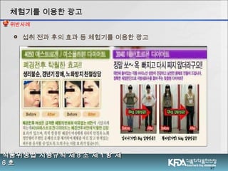  섭취 전과 후의 효과 등 체험기를 이용한 광고
27
식품위생법 시행규칙 제식품위생법 시행규칙 제 88 조 제조 제 11 항 제항 제
66 호호
체험기를 이용한 광고체험기를 이용한 광고
위반사례
 