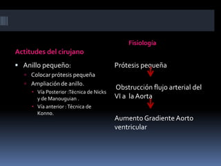 Actitudes y fisiología
Actitudes del cirujano
• Anillo pequeño:
• Colocar prótesis pequeña
• Ampliación de anillo.
• Vía Posterior :Técnica
de Nicks y de
Manouguian .
• Vía anterior : Técnica
de Konno.
Fisiología
Prótesis pequeña
Obstrucción flujo arterial del VI a
la Aorta
Aumento Gradiente Aorto
ventricular
 