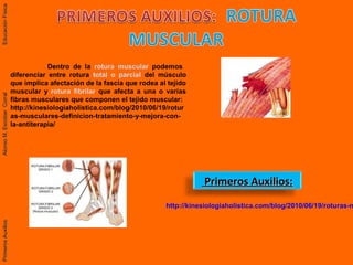 Primeros Auxilios:Primeros Auxilios:
Dentro de la rotura muscular podemos
diferenciar entre rotura total o parcial del músculo
que implica afectación de la fascia que rodea al tejido
muscular y rotura fibrilar que afecta a una o varias
fibras musculares que componen el tejido muscular:
http://kinesiologiaholistica.com/blog/2010/06/19/rotur
as-musculares-definicion-tratamiento-y-mejora-con-
la-antiterapia/
http://kinesiologiaholistica.com/blog/2010/06/19/roturas-m
PrimerosAuxiliosAlonsoM.EscobarCorralEducaciónFísicaPrimerosAuxiliosAlonsoM.EscobarCorralEducaciónFísica
 