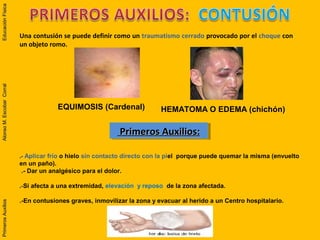 Una contusión se puede definir como un traumatismo cerrado provocado por el choque con
un objeto romo.
Primeros Auxilios:Primeros Auxilios:Primeros Auxilios:Primeros Auxilios:
.-.- Aplicar frío o hielo sin contacto directo con la piel porque puede quemar la misma (envuelto
en un paño).
.- Dar un analgésico para el dolor.
.-.-Si afecta a una extremidad, elevación y reposo de la zona afectada.
.-En contusiones graves, inmovilizar la zona y evacuar al herido a un Centro hospitalario.
EQUIMOSIS (Cardenal) HEMATOMA O EDEMA (chichón)
PrimerosAuxiliosAlonsoM.EscobarCorralEducaciónFísicaPrimerosAuxiliosAlonsoM.EscobarCorralEducaciónFísica
 